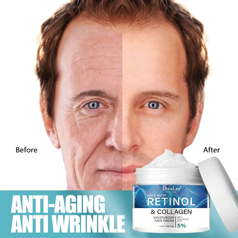 Retinol Anti-wrinkle Cream